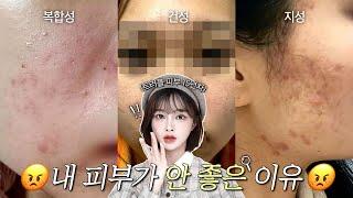 트러블 고민상담‍️ 피부타입별 트러블 스킨케어 루틴 | 나에게 꼭 맞는 스킨케어 추천