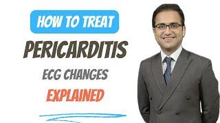 Pericarditis Symptoms, Treatment, ECG Changes, Pathology, Explained, Medicine Lecture, USMLE NEETPG