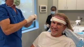 Southside Steve's Hair Transplant: The Surgery Day