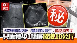 少吃1食物　女子「治好」脂肪肝更勁瘦10公斤　醫生一看超驚訝｜01熱話｜脂肪肝｜高血壓｜健康