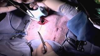 Gastropexy and Ovariectomy in a female Great Dane