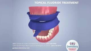 Fluoride Treatment