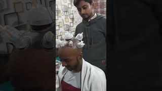 Head hijama || SKM Physiotherapy & Rehabilitation center [best cupping and hijama Therapy Center]