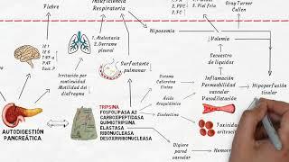 Fisiopatología de la pancreatitis aguda en 6 minutos