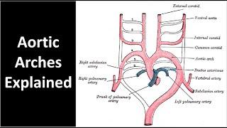 Aortic Arches Explained