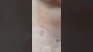 when you dizzy