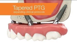 Tapered PTG dental implants: Expanding clinical protocols