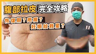 腹部拉皮必看！產後&大量減重好鬆弛抽脂不夠？就靠拉皮！｜台南杰美學 周杰醫師