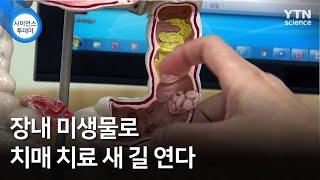 장내 미생물로 치매 치료 새 길 연다 / YTN 사이언스