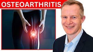 Osteoarthritis - Dr Paul Mason