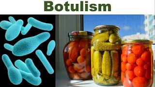 Canned Foods and Botulism: What Every Consumer Should Know | Clostridium botulinum | Botulinum Toxin