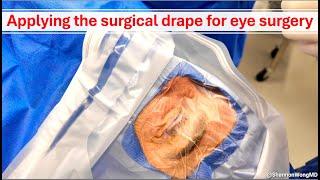 How I apply the surgical drape for eye (cataract) surgery.  Shannon Wong, MD.