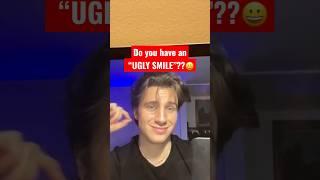 Do you have an “UGLY SMILE”??