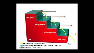 Neonatal aEEG by Dr Cesar part 2