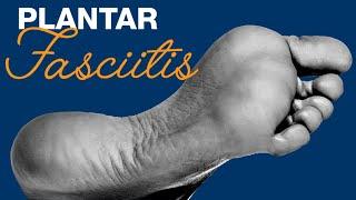 Airrosti Treatment: Plantar Fasciitis