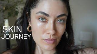 everything I have done to have consistent good skin | Melissa Alatorre