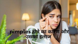 Pimples On FACE - Why Do They Happen? #shorts #livetsream#livetipsandtricks