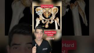 Orthopedic surgeon reacts to crazy orthopedic surgery cases