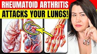 Warning: Rheumatoid Arthritis And Lung Problems