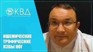 1443  Ишемические трофические язвы ног