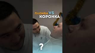 Как понять, когда нужно ставить коронку? #стоматолог #коронканазуб