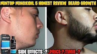 mintop minoxidil 5 beard growth result | best minoxidil for beard growth | minoxidil beard growth|