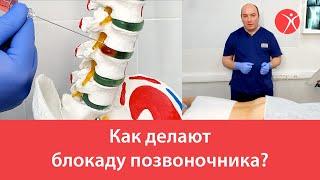 Как делают блокаду позвоночника?