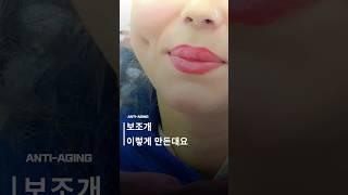 보조개 이렇게 만든대요