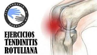 Tendinitis rotuliana, ejercicios, tratamiento y rehabilitacion