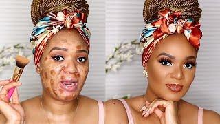 EVERYDAY SOFT NEUTRAL GLAM : PROBLEM SKIN | OMABELLETV