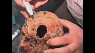 MNF Medad Team | Dr. Ayman Abdallah H&N Practical Anatomy [ Bone 01 ]