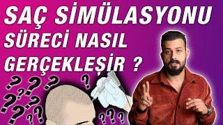 Saç Simülasyonu Süreci Nasıl Gerçekleşir ? Uzm.Est.Semih DENİZ