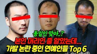 동일인인게 믿기지 않는다는 가발 논란 연예인 Top 6