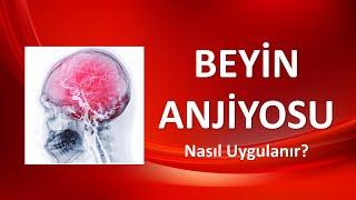 BEYİN ANJİYOSU Nasıl Uygulanır?