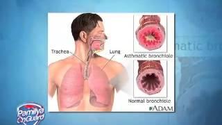 THIRD-HAND SMOKE MAY CAUSE CANCER: EXPERTS