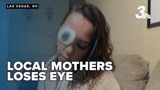 Mother of three loses eye after being shot while driving down Las Vegas dead-end