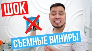 Съемные виниры, просто ШОК, покупать или нет?