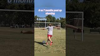 Shooting Progress 6 Vs 7 Months Post Acl Surgery #acl #soccer #aclrecovery