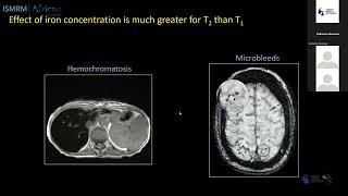 Basic MRI Techniques/ Sequences- Andrew Webb