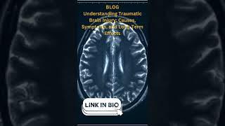 Unlocking Hope: Navigating Life After Brain Injury at Assured Senior Living #braininjury