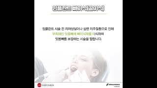 알아두면 쓸데있는 신비한 임플란트 용어 2탄! [대구 덕영치과병원]