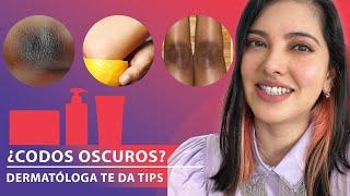 CODOS y RODILLAS percudidos, tips para codos BONITOS