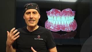 Differenza tra protesi fissa su impianti dentali e protesi mobile - Dr Roldano Romolini Odontoiatra