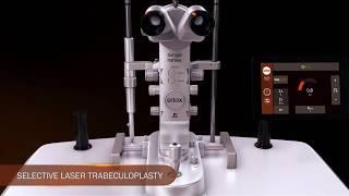 Ellex Selective Laser Trabeculoplasty (SLT) Animation