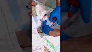 Hemodialysis #viralvideo #neet2025 #neetpreparation #biology