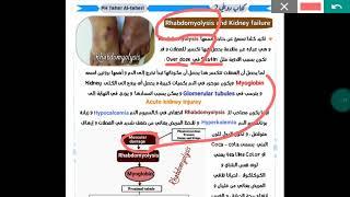 علاقة Rhabdomyolysis بـ Kidney failure و شرح اسباب حدوثها و بعض الملاحظات عليها ..