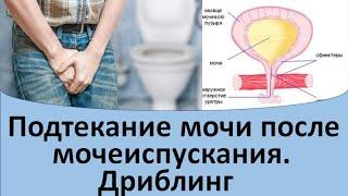 Подтекание мочи после мочеиспускания.  Дриблинг