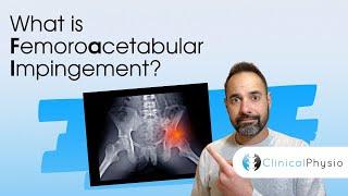 What is Femoroacetabular Impingement? | Expert Physio Review