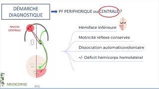 Nerf facial et paralysie faciale périphérique - ECN & FMC - Anatomie