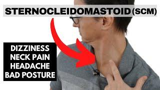 Sternocleidomastoid (SCM): neck pain, headaches, and cervicogenic dizziness